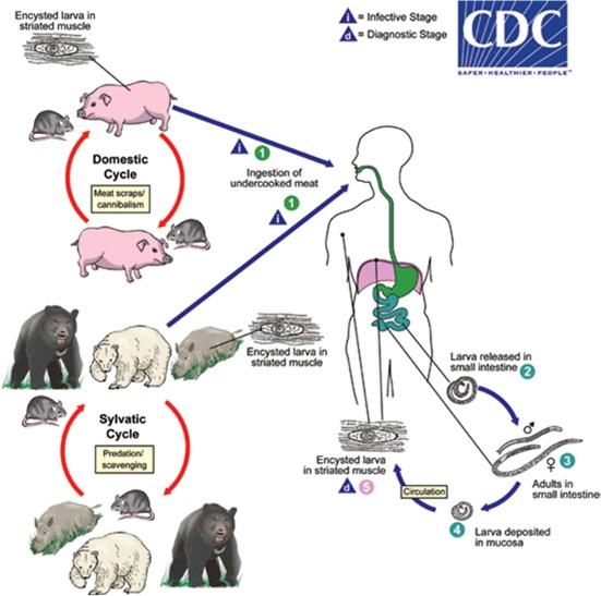 Life cycle of Trichinella